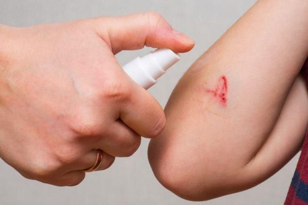 Mengenal 5 Jenis Luka dan Peran Perawat Luka