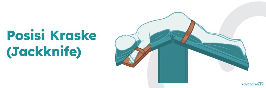 Posisi Jackknife: Definisi, Manfaat, dan Langkah 8 Infografis Posisi Berbaring Jackknife Kavacare