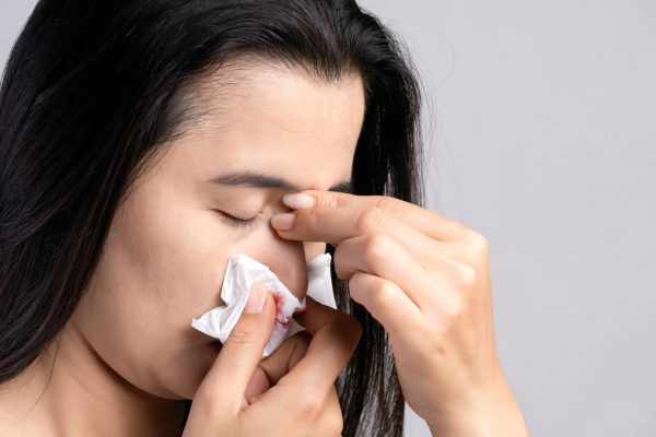 Cara Meredakan Mimisan: 4 Langkah Tepat dan Cepat