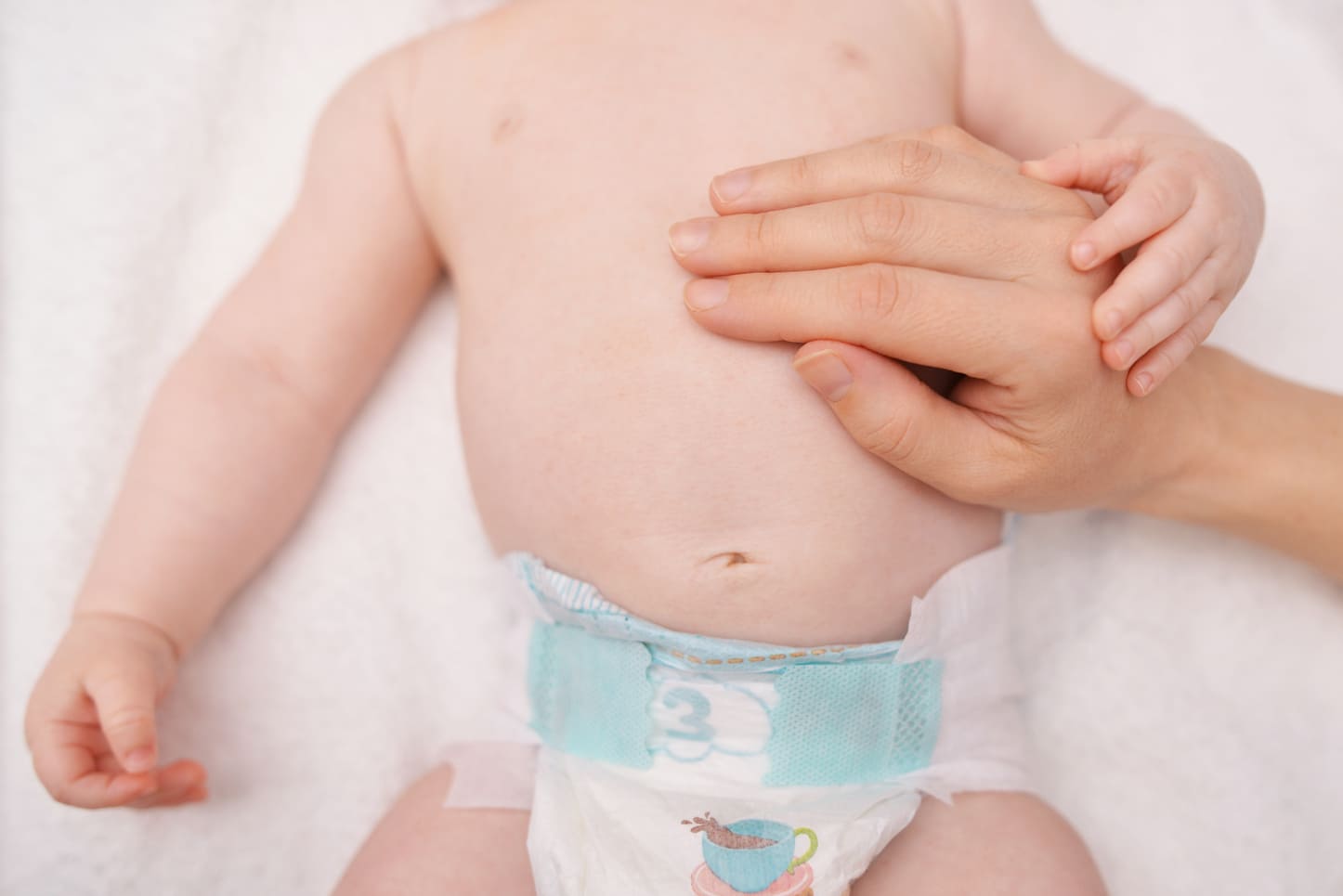 Read more about the article Kenali Ciri-ciri Hernia pada Bayi