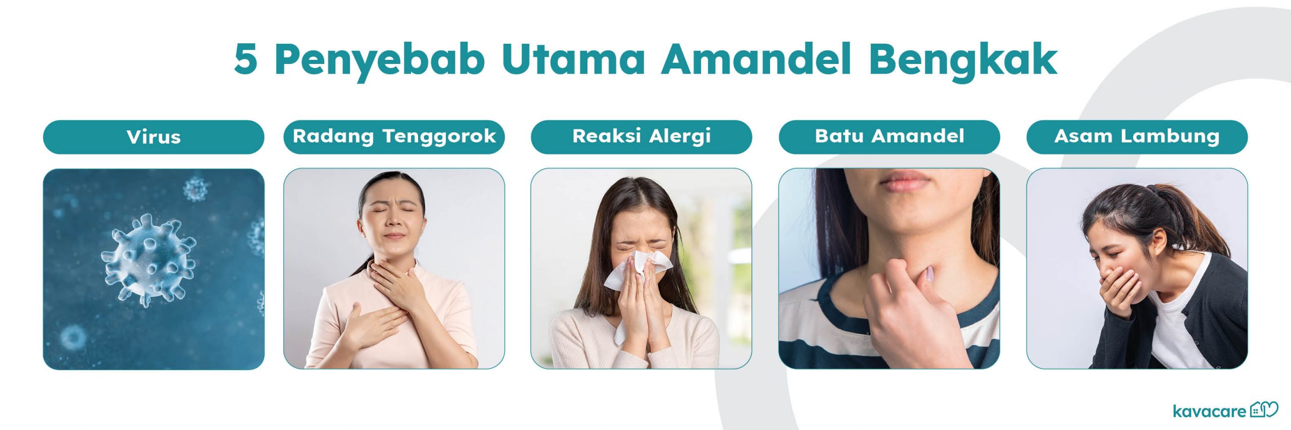 5 Penyebab Amandel Bengkak, Apa Saja? 8 Infografis Penyebab Utama Amandel Bengkak Kavacare
