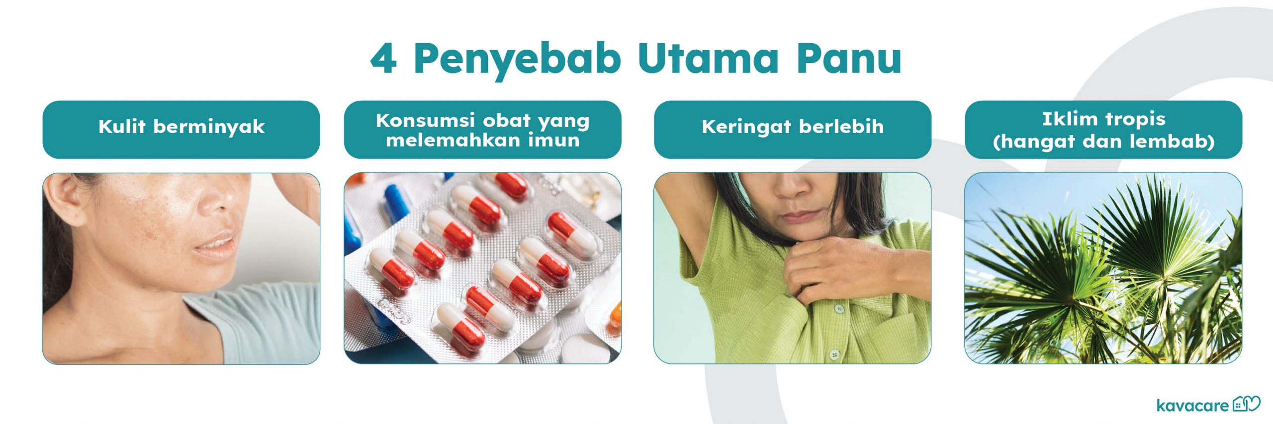  Infografis 4 Penyebab Utama Panu Kavacare