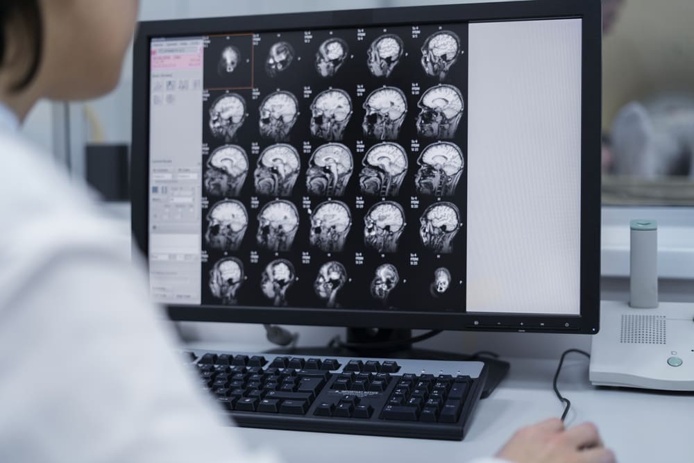 CT Scan Kavacare foto radiologi, jenis-jenis radiologi
