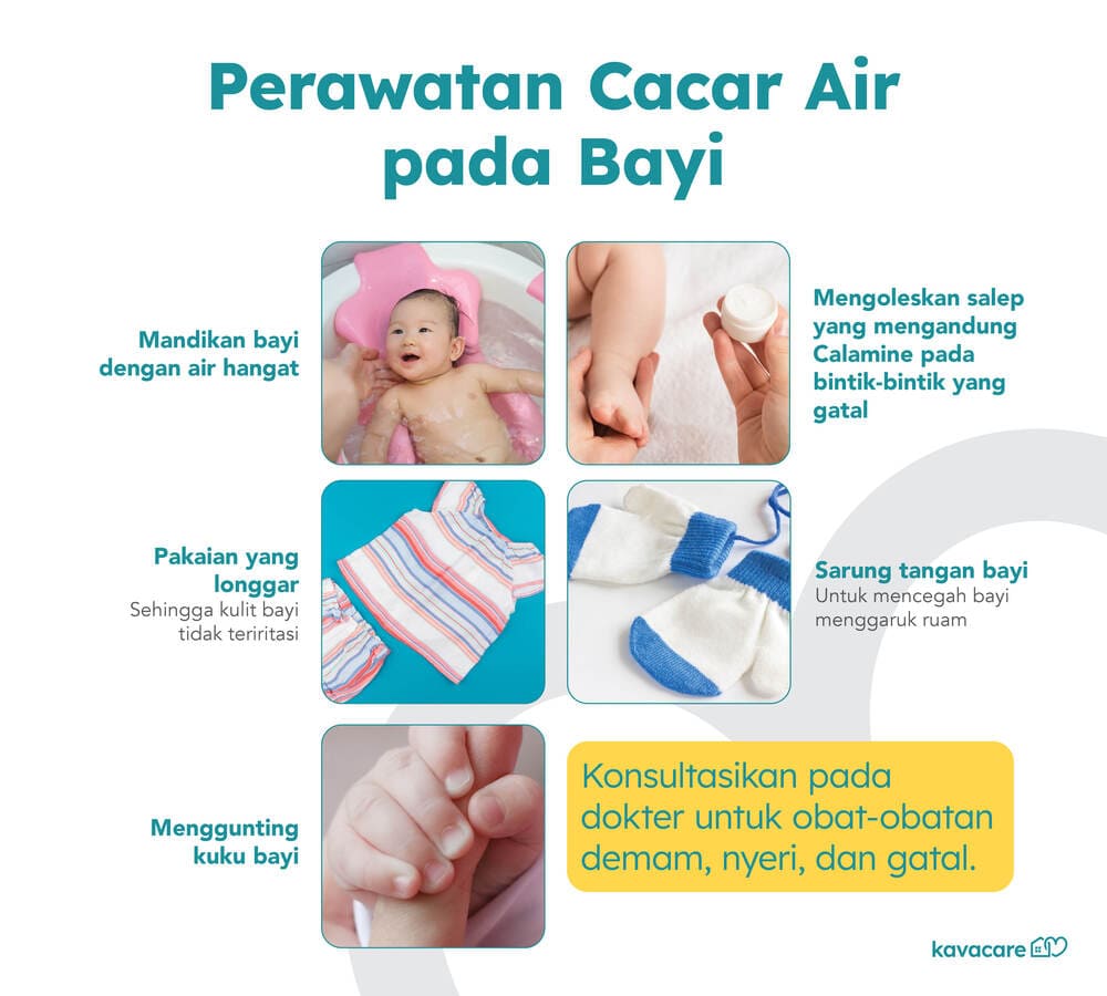 Infografis Perawatan Cacar Air pada Bayi Kavacare