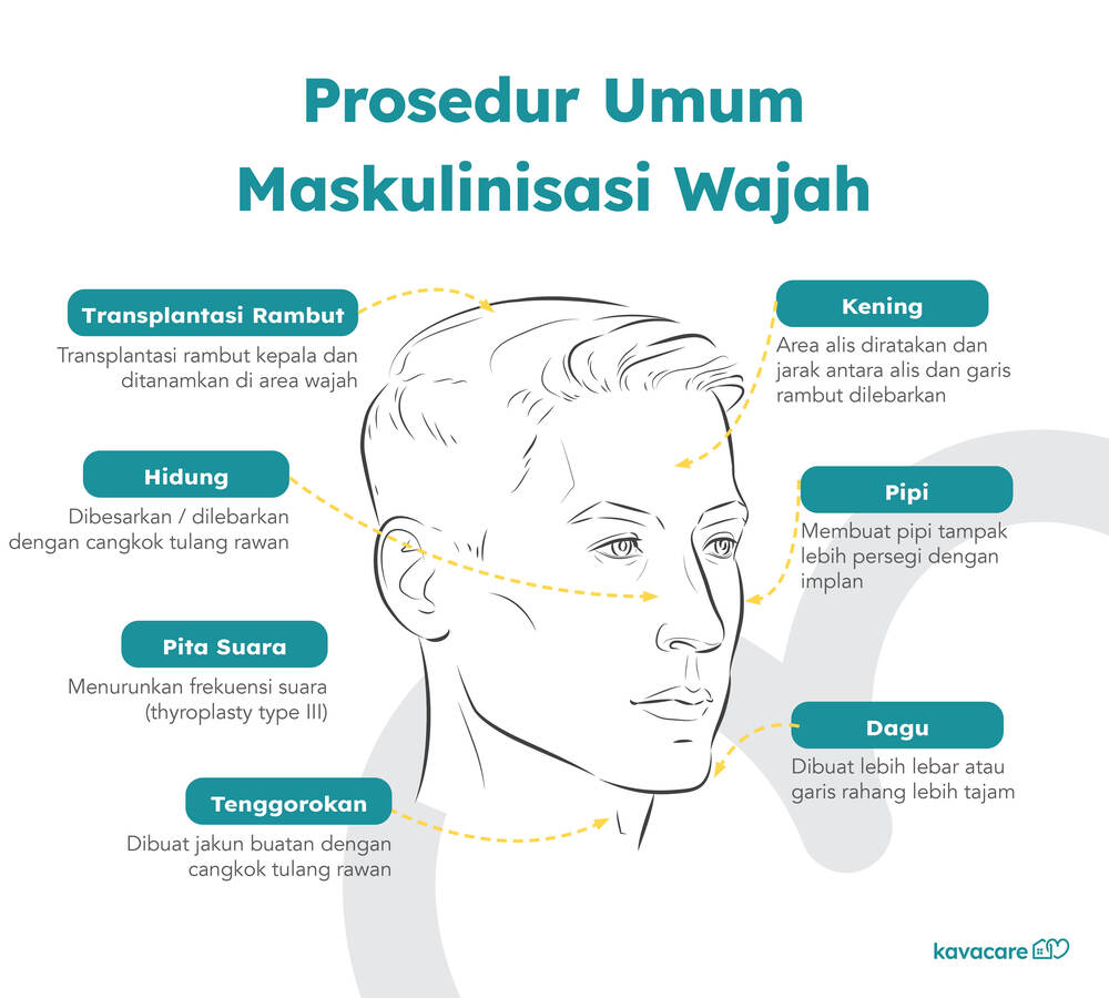 Infografis Prosedur Maskulinisasi Wajah Kavacare