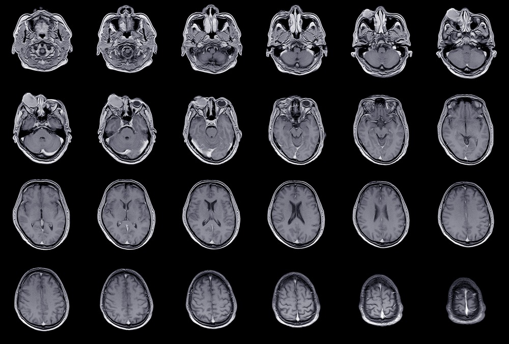MRI Kavacare Radiologi, jenis-jenis radiologi