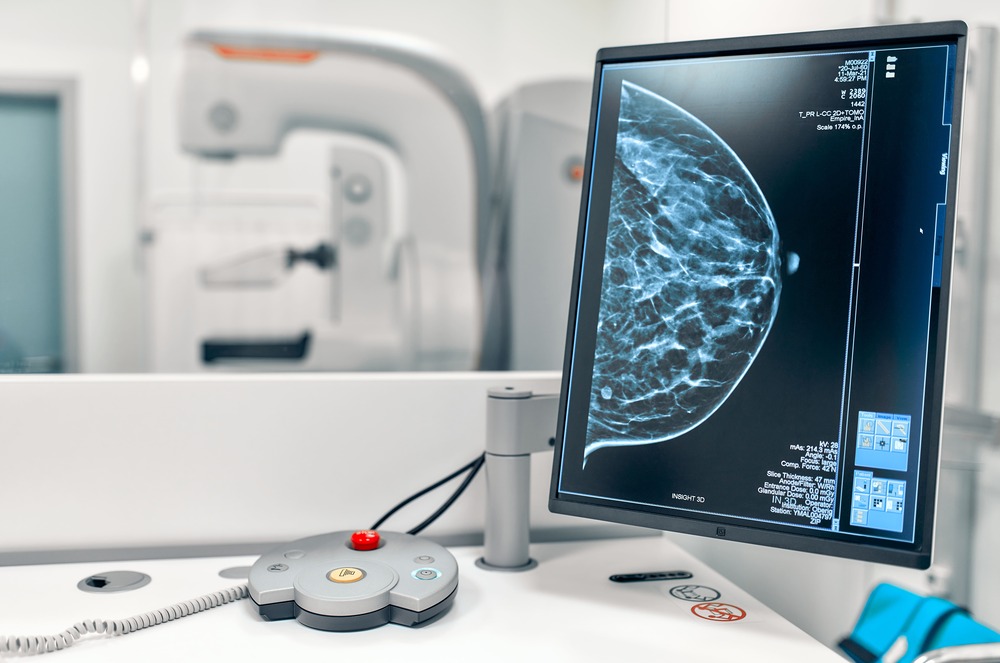 Mammografi Kavacare Radiologi, jenis-jenis radiologi