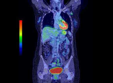 PET SCAN Kavacare Radiologi, jenis-jenis radiologi