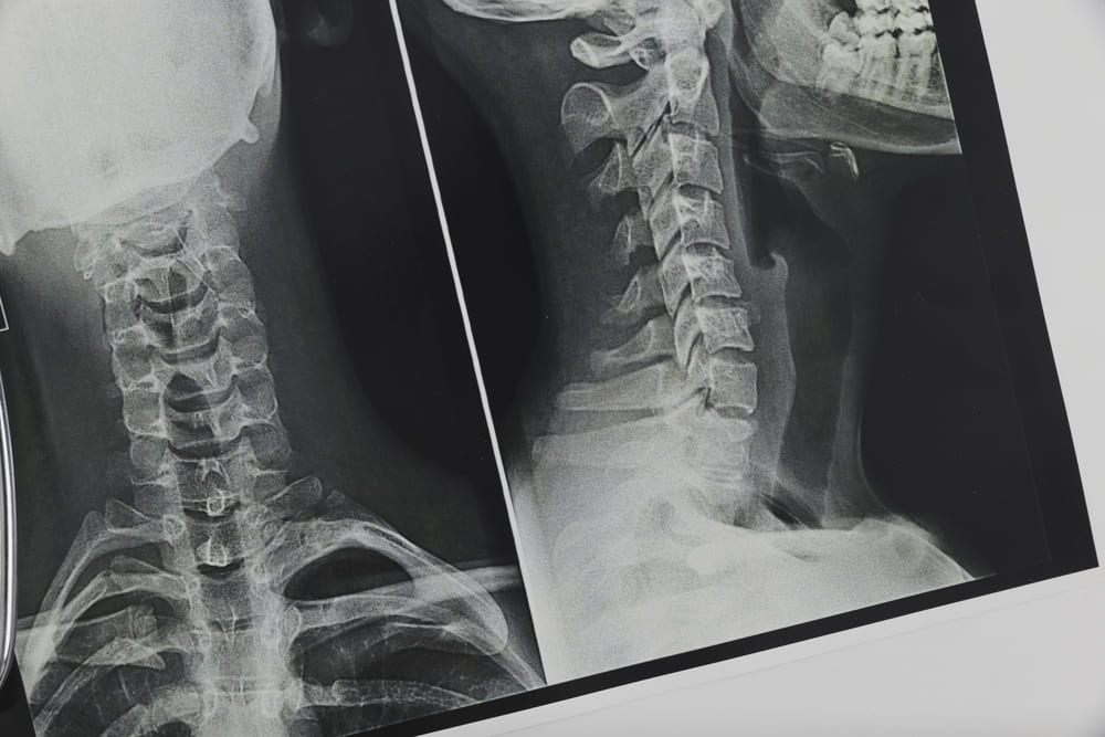 X-ray Kavacare foto radiologi, jenis-jenis radiologi