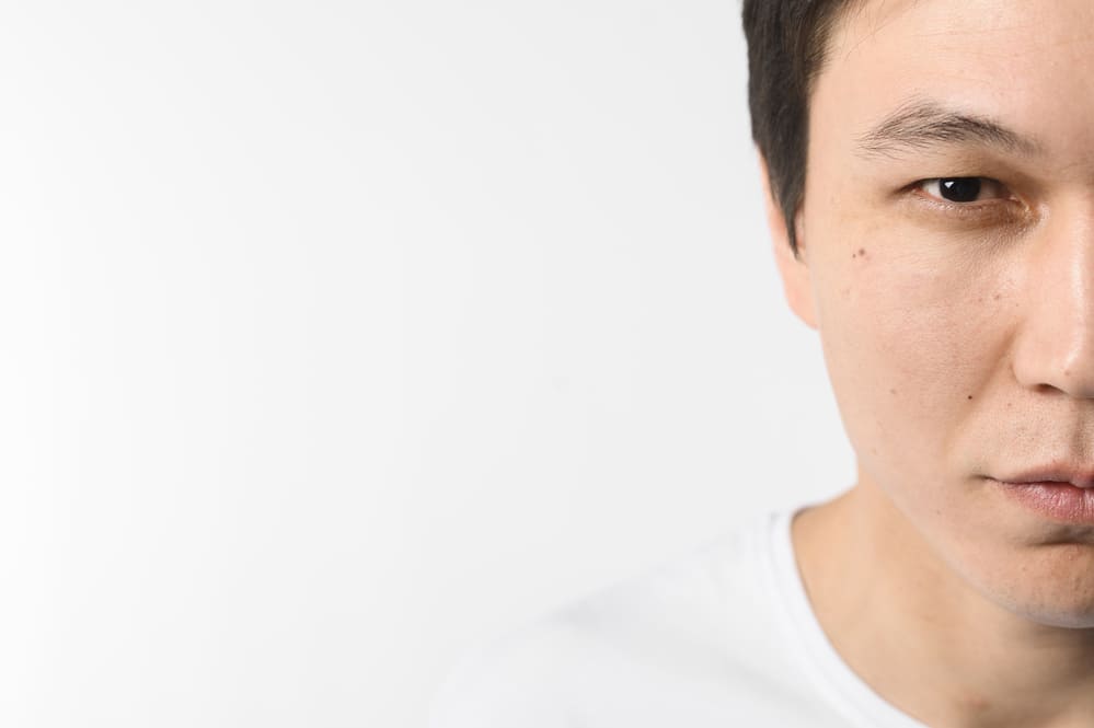 Read more about the article Bell’s Palsy: Gejala dan Penanganan