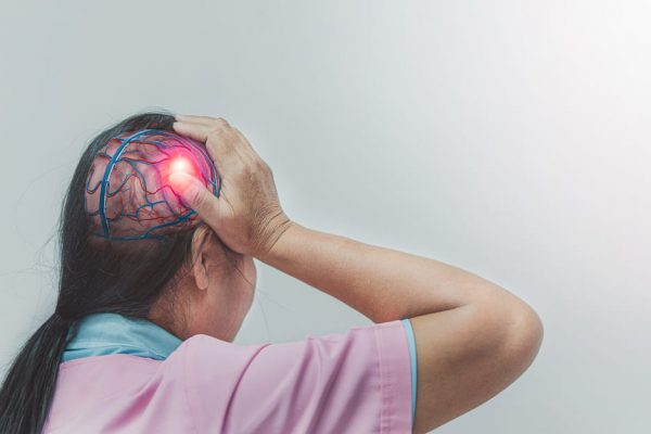 Stroke Hemoragik: Gejala dan Penanganan