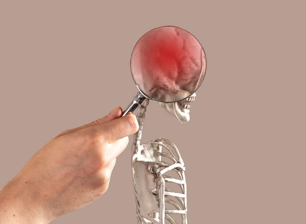 Meningitis: Gejala dan Penyebab 7 Meningitis Gejala dan Penyebab