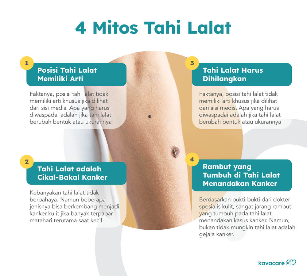 Infografis Mitos Tahi Lalat - Kavacare