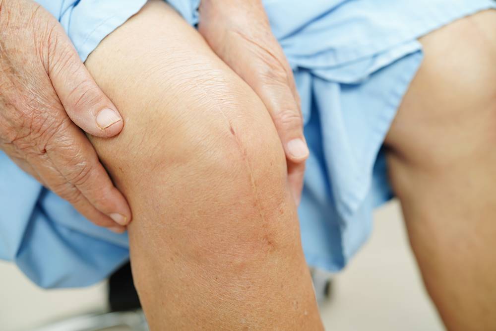 Robotic Knee Replacement, penggantian lutut