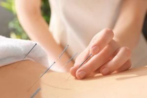 manfaat akupuntur, cara mengatasi nyeri