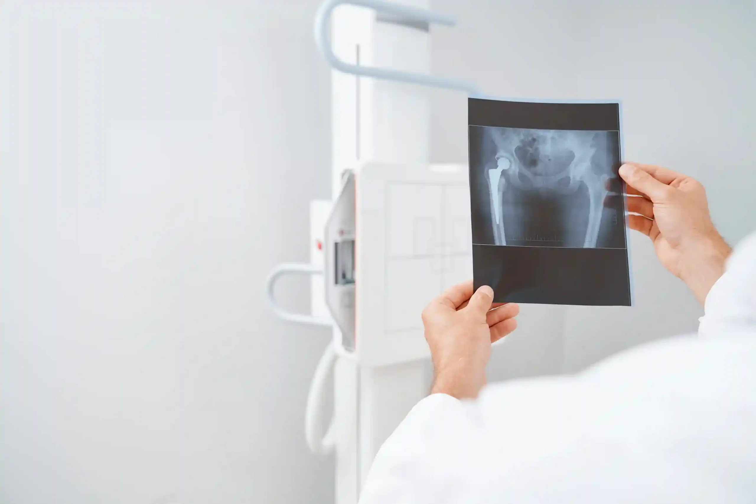 Mengenal Tumor Tulang: Jenis - Jenis, Gejala, Penyebab dan Cara Pencegahan 7 Mengenal Tumor Tulang: Jenis - Jenis, Gejala, Penyebab dan Cara Pencegahan Kavacare