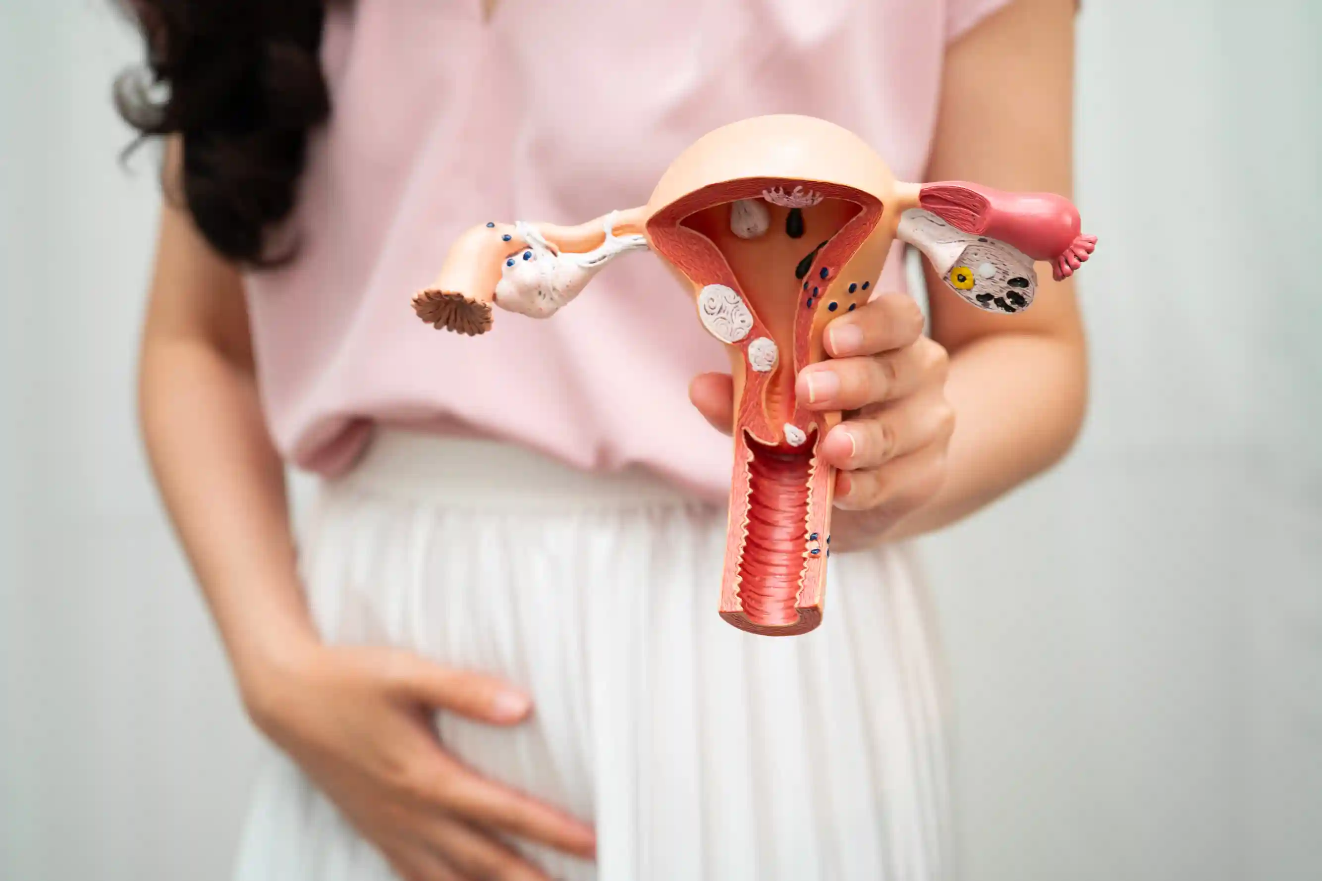 Read more about the article Waspadai! Ini 7 Ciri-Ciri Kista Ovarium pada Wanita yang Sering Diabaikan