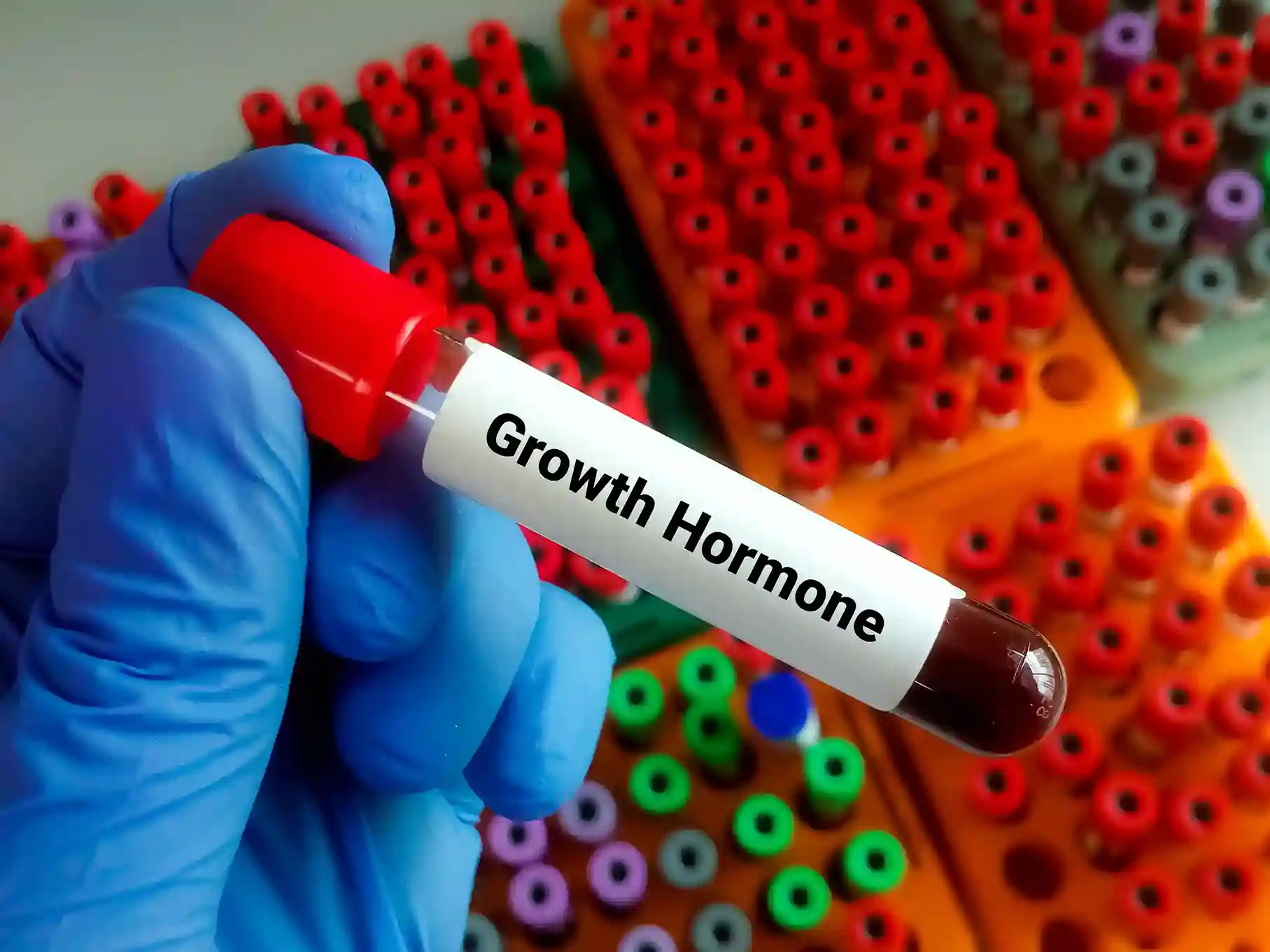 Read more about the article Apa Saja Manfaat Growth Hormone (GH) bagi Kesehatan Tubuh?