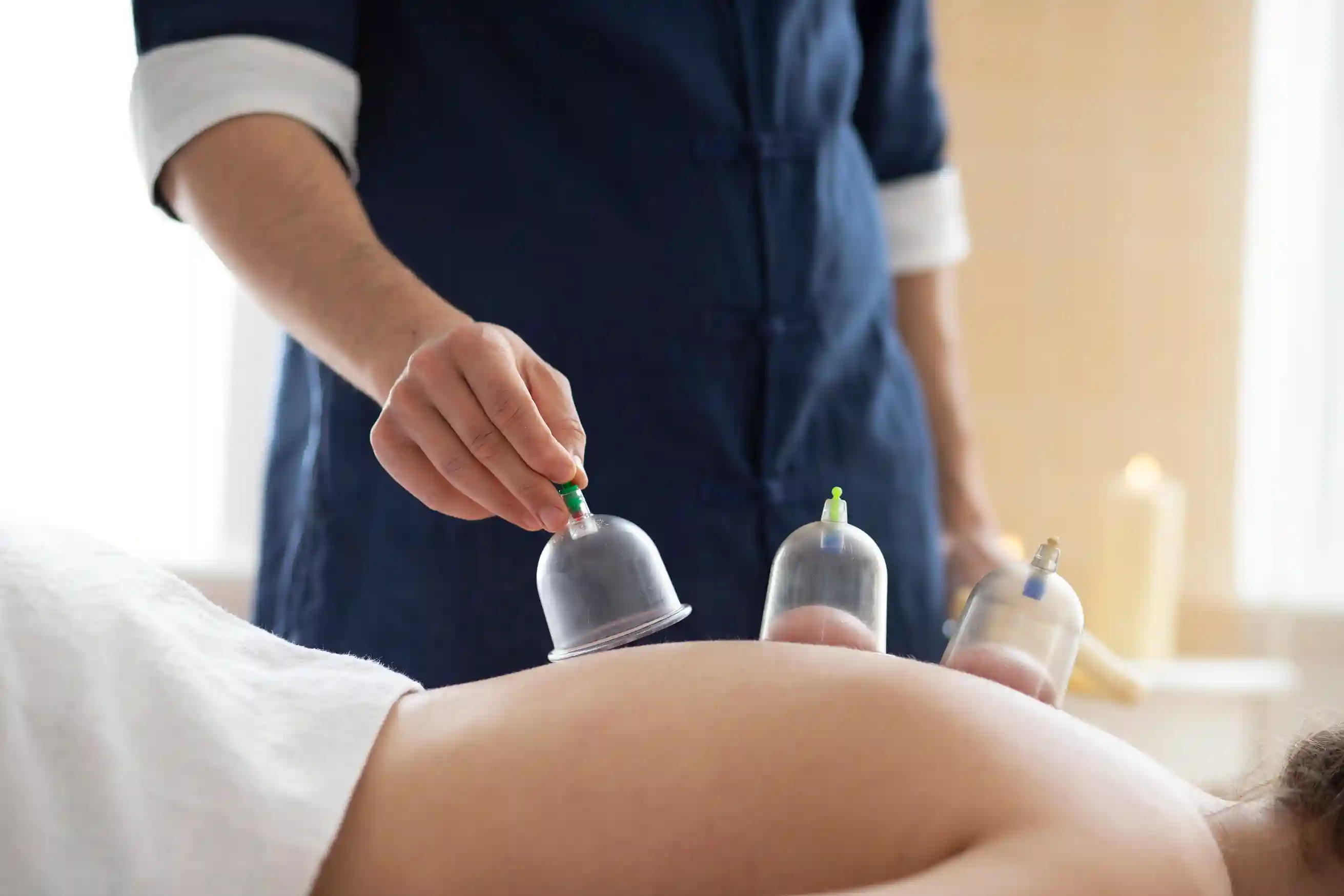Read more about the article Apa Manfaat Bekam bagi Kesehatan Tubuh?