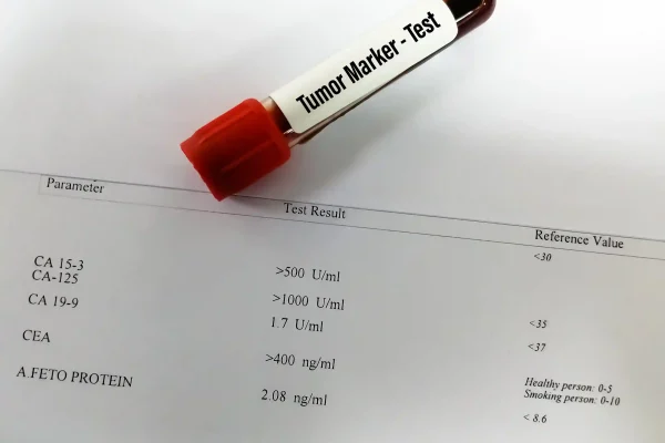Apa Tujuan Pengukuran Tumor Marker?
