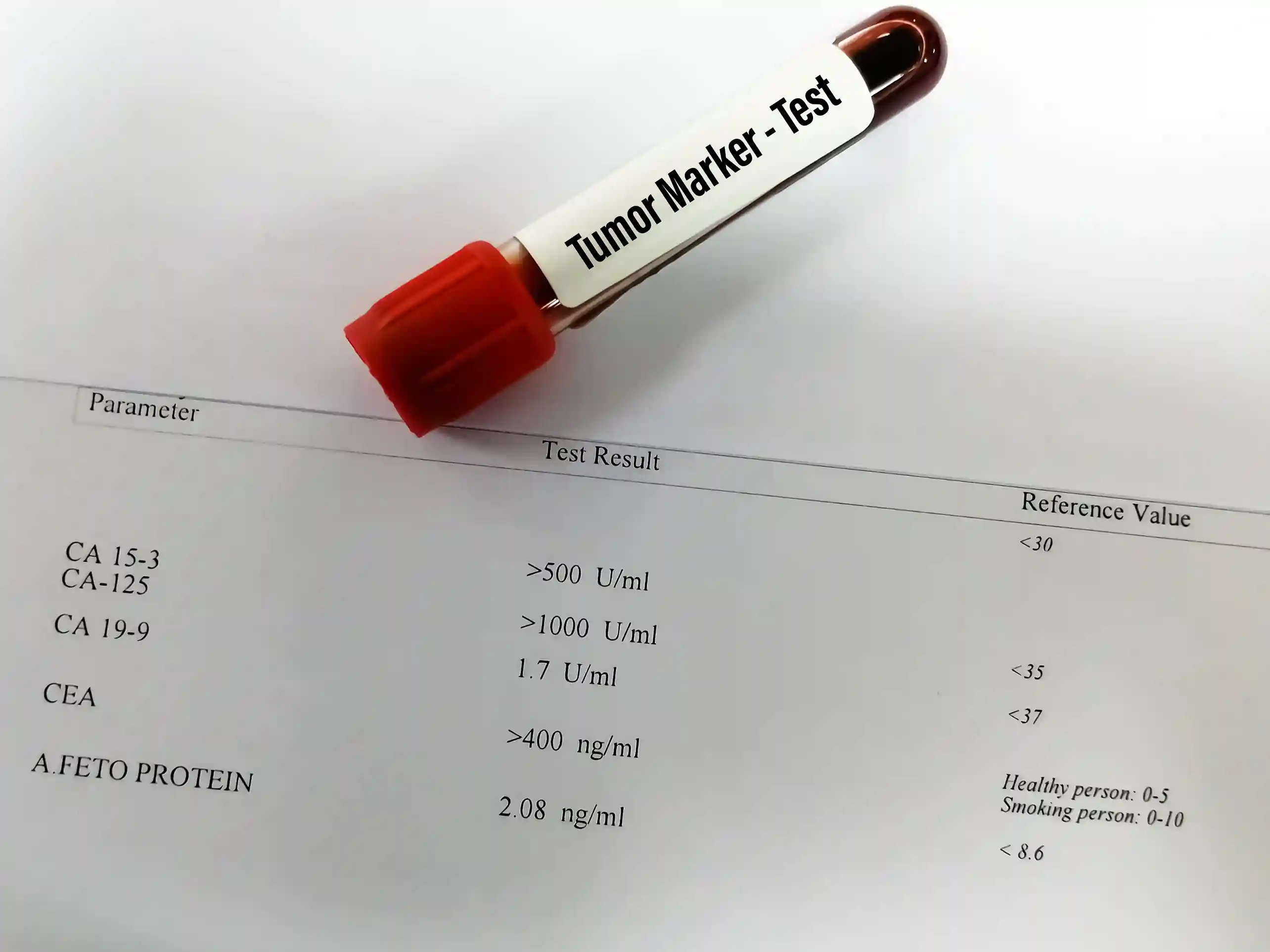 Read more about the article Apa Tujuan Pengukuran Tumor Marker?