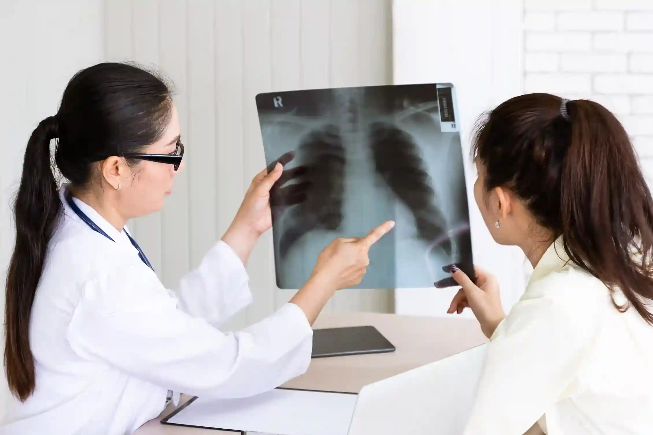 Read more about the article Mengapa Skrining Tuberkulosis pada Anak Penting Dilakukan?